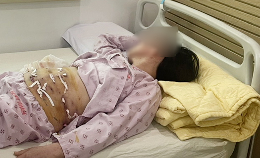 Tai biến nguy hiểm khi tiêm chất làm đẹp